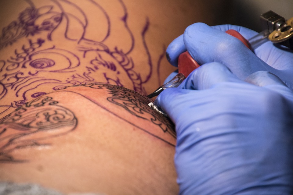 Tatuajes:¿cómo puedo eliminarlos?